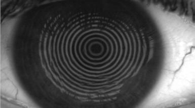 Film lacrimale-scienza dei materiali-ottica e optometria-unimib